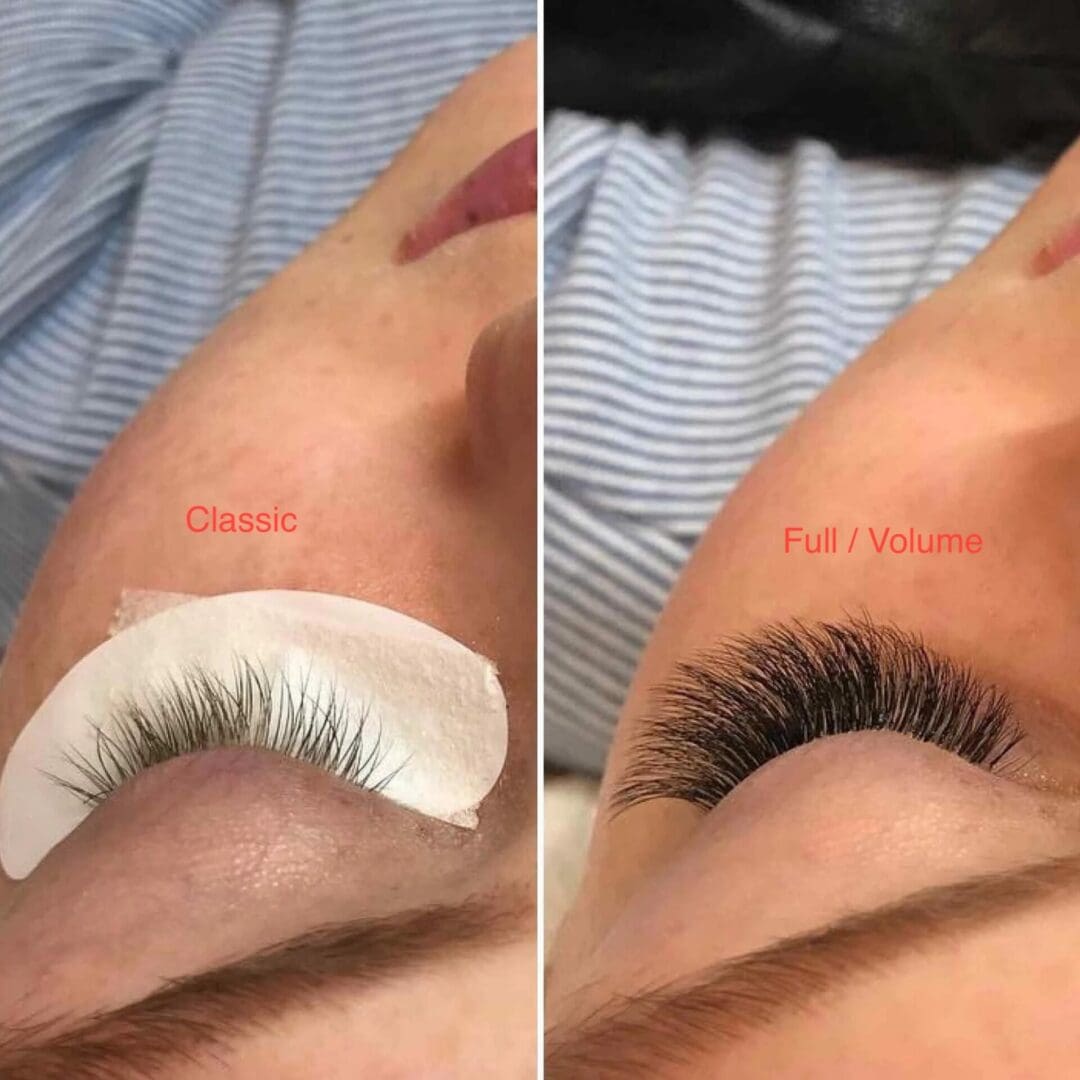 Classic vs Full Set