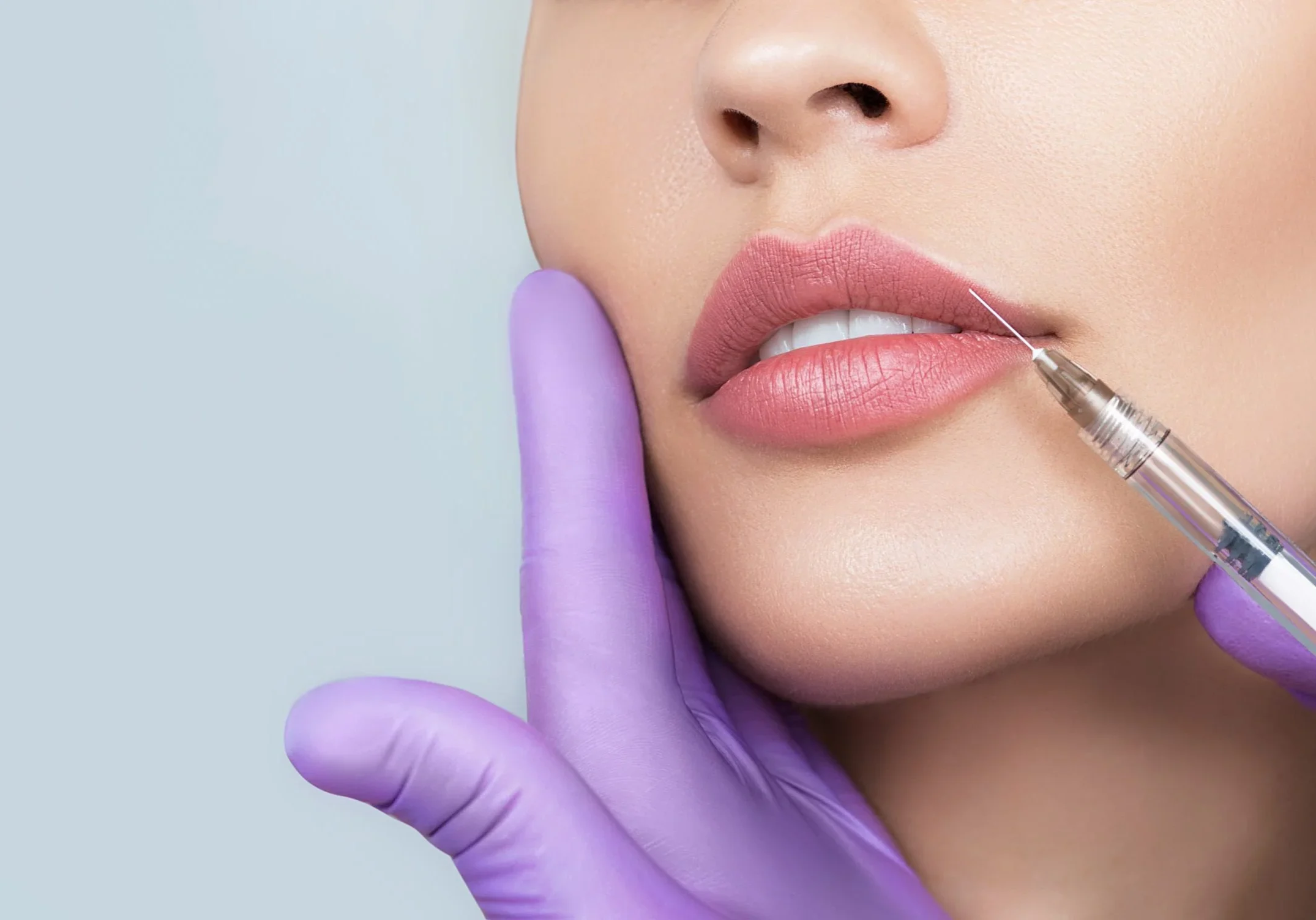 A cosmetic procedure injecting lips with a syringe.